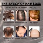 Rosemary Anti-Breakage Nourishing Hair Care Oil - Image 9