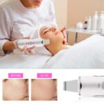 3-in-1 Ultrasonic Facial Spatula For Deep Cleansing, Electric Ultrasonic Skin Scrubber - Image 6