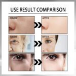 Snail Cream Fading Wrinkle French Lines Replenishment Firming Skin Anti-Aging - Image 4