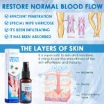 30ml Varicose Vein Spray Multi-Purpose Knee And Leg Care Spray Promote Blood Circulation - Image 4
