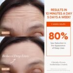 7 Color Cordless LED Face Mask For Wrinkle & Acne Reducing - Black - Image 7