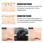 10 Pcs Blackhead Nose Patch Nose Pore Cleansing Strips Deep Cleansing Blackhead Remover Strips For Women Men - Image 4