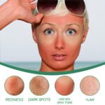 West&Month Color Correcting Care Cream For Diminishing Spots, Post-sun Recovery, Nourishing, And Enhancing The Skin's Beauty - Image 6