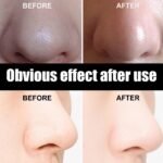 10 Pcs Blackhead Nose Patch Nose Pore Cleansing Strips Deep Cleansing Blackhead Remover Strips For Women Men - Image 6