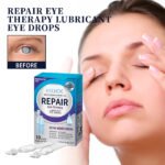 EELHOE Eye Drops Relieve Redness And Blurred Eyes Eye Fatigue Dryness Blurred Vision Moisturizing Eye Care Solution - Image 2
