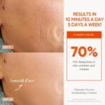 7 Color Cordless LED Face Mask For Wrinkle & Acne Reducing - Black - Image 2